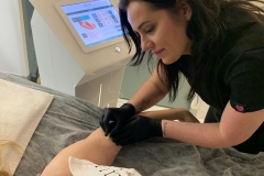 Belle-spa-clinic_karboksyterapia-motylki