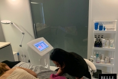Belle-spa-clinic_karboksyterapia-rozstępy