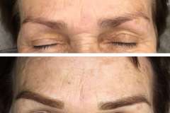 Belle-spa-clinic_makijaz-permanentny-u-starszej-ososby