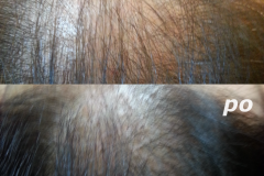 Belle-spa-clinic_trychologia-łysienie-na-tle-hormonalnym